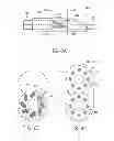 Fig. 09 - Electrical stimulation lead with junction and methods of making and using