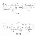 Fig. 02 - MRI compatible co-radially wound lead assembly