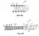 Fig. 07 - MRI compatible co-radially wound lead assembly