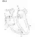 Fig. 06 - X-ray identification for active implantable medical device
