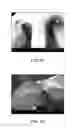 Fig. 13 - Crush recoverable polymer scaffolds