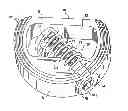 Fig. 01 - SPINAL IMPLANTS