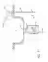 Fig. 09 - Tailpiece and sink drain assembly system