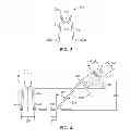 Fig. 03 - REINFORCING ASSEMBLY HAVING WORKING MEMBERS WITH NON-PLANAR TIPS