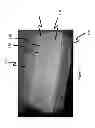 Fig. 02 - PACKAGES AND METHODS FOR STORING AND TRANSPORTING PERISHABLE FOODS