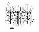 Fig. 01 - Method for producing a net with elongated stitches