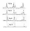 Fig. 06 - Resonant signal analysis-based inspection of rail components