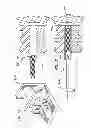 Fig. 06 - SELECTIVELY COATING LUMINAL SURFACES OF STENTS