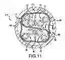 Fig. 07 - S-SHIELD TWISTED PAIR CABLE DESIGN FOR MULTI-GHZ PERFORMANCE