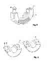 Fig. 04 - FASTENING DEVICE FOR A LINE AND METHOD FOR FASTENING A LINE