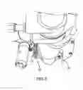 Fig. 06 - Idle Gear Remote Grease Line