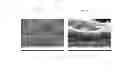 Fig. 03 - Removable anodising agent, in particular for local anodic oxidation of metal surfaces