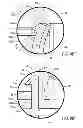 Fig. 10 - Endcap bypass plug, endcap assembly and filter assembly