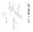 Fig. 02 - Laser engraving device