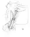 Fig. 02 - Valved fluid transport container