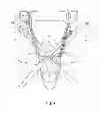 Fig. 06 - Compound helicopter with tail booms