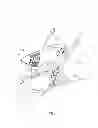 Fig. 04 - Infant supporting mechanism