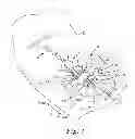 Fig. 02 - Medical article securement systems and methods of using same