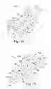 Fig. 09 - Medical article securement systems and methods of using same