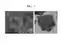 Fig. 04 - Nitride semiconductor device and method of manufacturing the same