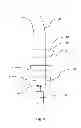 Fig. 04 - METHODS AND APPARATUS FOR USE IN THE MANUFACTURE OF INNERSPRING ASSEMBLIES
