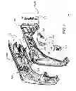 Fig. 09 - LASER WELDED STRUCTURAL FENDER INNER BLANK FOR MASS OPTIMIZATION