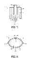 Fig. 04 - Sealing compound and ceramic discharge vessel comprising such sealing compound