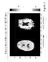 Fig. 07 - Automated MRI detection of tissue macromolecular T2/T2* characteristics using Z-spectra
