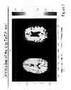 Fig. 06 - MRI detection of tissue macromolecular characteristics using MTC effects