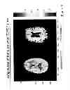 Fig. 07 - MRI detection of tissue macromolecular characteristics using MTC effects