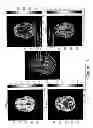Fig. 16 - MRI detection of tissue macromolecular characteristics using MTC effects