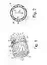 Fig. 02 - Split gradient coil and hybrid systems using same