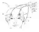 Fig. 01 - Electrode Blinking Device