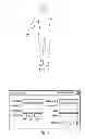 Fig. 07 - Method and system of producing 2D representations of 3D pain and stimulation maps and implant models on a clinician programmer