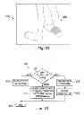 Fig. 22 - Method and system of producing 2D representations of 3D pain and stimulation maps and implant models on a clinician programmer