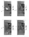 Fig. 20 - Virtual access control