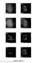 Fig. 06 - MOTION-COMPENSATED CONFOCAL MICROSCOPE
