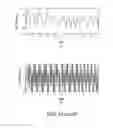Fig. 07 - MOTION-COMPENSATED CONFOCAL MICROSCOPE