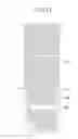 Fig. 11 - Liquid crystal display