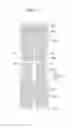 Fig. 17 - Liquid crystal display