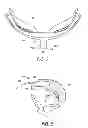 Fig. 06 - Eyewear having multiple ventilation states