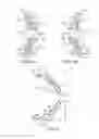 Fig. 04 - Eyewear having a flexural member