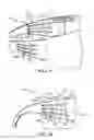 Fig. 06 - Eyewear having a flexural member