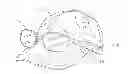 Fig. 01 - Eyeglasses retention system