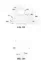 Fig. 02 - Method and apparatus of forming a translating multifocal contact lens having a lower-lid contact surface