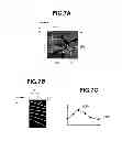 Fig. 08 - Image processing apparatus and image processing system for displaying information about ocular blood flow