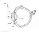 Fig. 01 - Multi-focal intraocular lens system and methods for dynamic visual environments