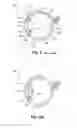 Fig. 02 - Multi-focal intraocular lens system and methods for dynamic visual environments