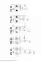 Fig. 04 - Multi-focal intraocular lens system and methods for dynamic visual environments