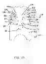 Fig. 05 - Damped dual stage actuation disk drive suspensions